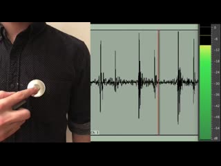 sample human heartbeat